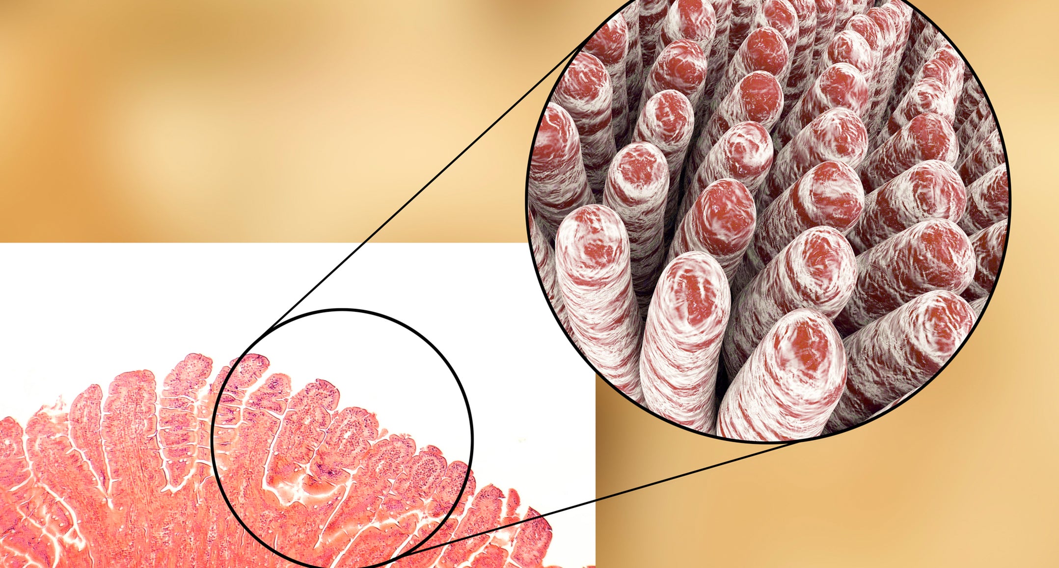 Grape Pomace Extracts and Gut Health: A Closer Look at Intestinal Barrier Function